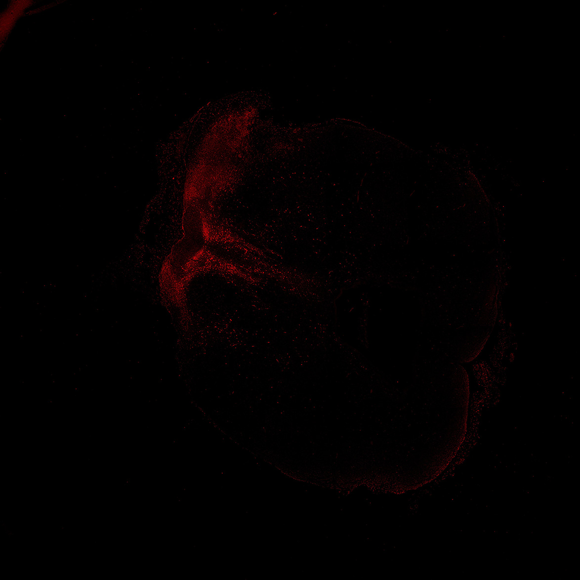 Human foetal midbrain